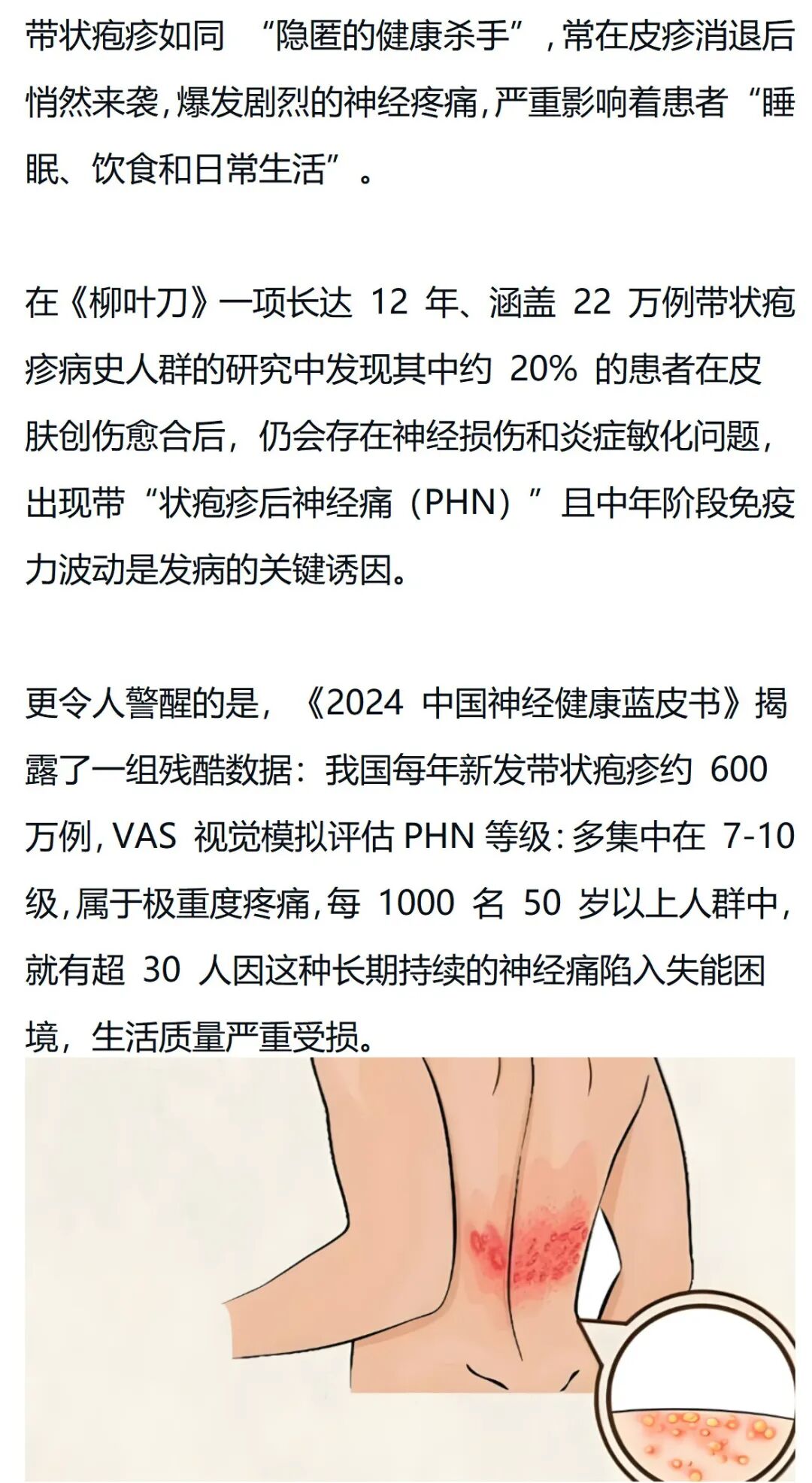 带状疱疹神经痛有福了！北美进口补剂实证有效!或惠3亿人