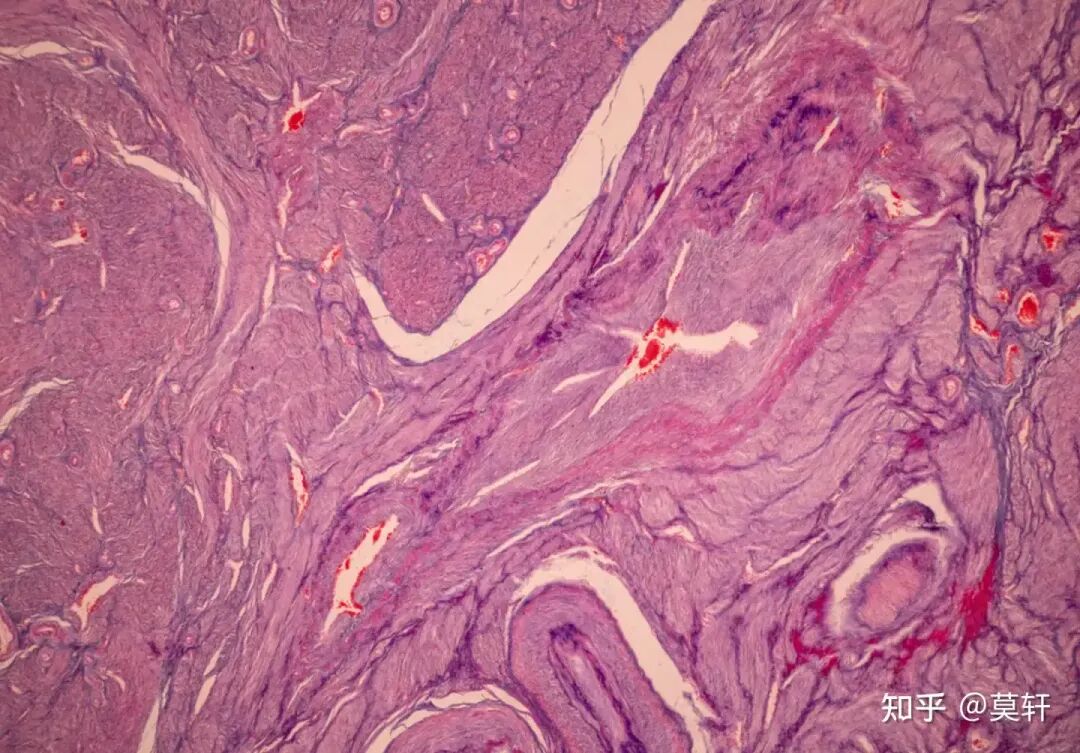 科普丨炖肉时的浮沫，是营养还是脏东西？要不要撇去？